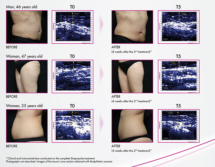 before-after